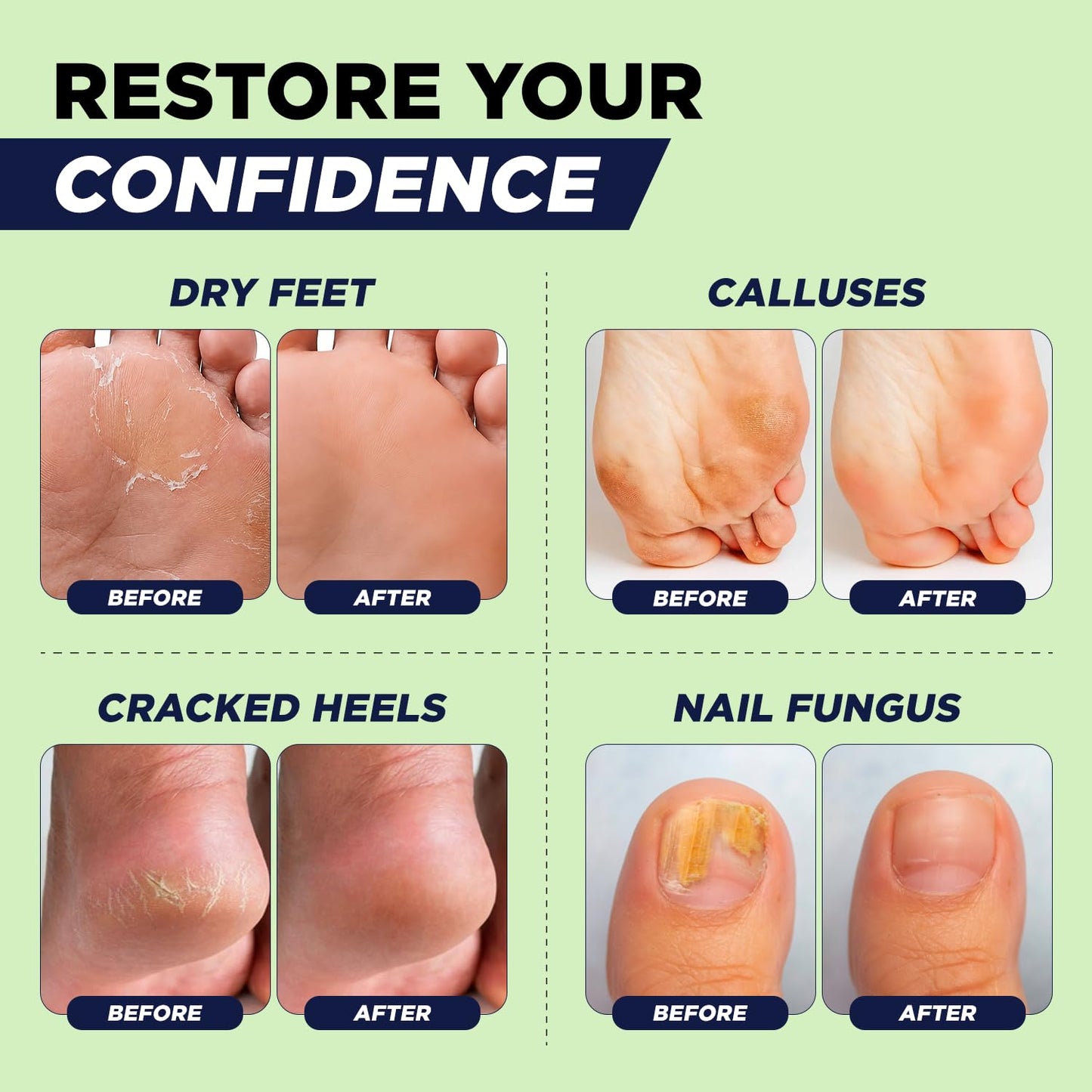 Tea Tree Oil Foot Soak with Epsom Salt - For Toenail Repair, Athletes Foot, Softens Calluses, Soothes Sore & Tired Feet, Nail Discoloration, odor Scent, Spa Pedicure Care - Made in USA 16 oz