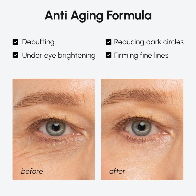 MAREE Under Eye Balm Stick Hydrating – Retinol Caffeine Under Eye Brightener Stick for Older Women – Collagen Undereye Cream for Dark Circles & Wrinkles – Skin Care Treatment Moisturizer