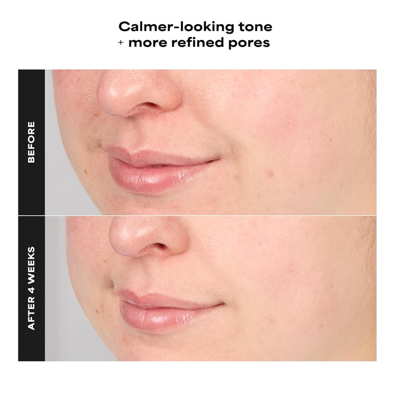 Paula's Choice SKIN PERFECTING 4% BHA Exfoliating Serum - Anti-Aging Facial Toner for Smooth Skin & Pore Minimization, Fragrance-Free