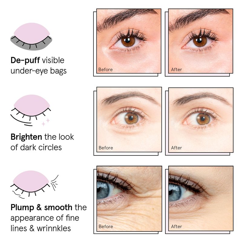 Grace & Stella Under Eye Patches - 12 Pairs of Eye Masks for Dark Circles & Puffiness | Vegan, Cruelty-Free Skin Care