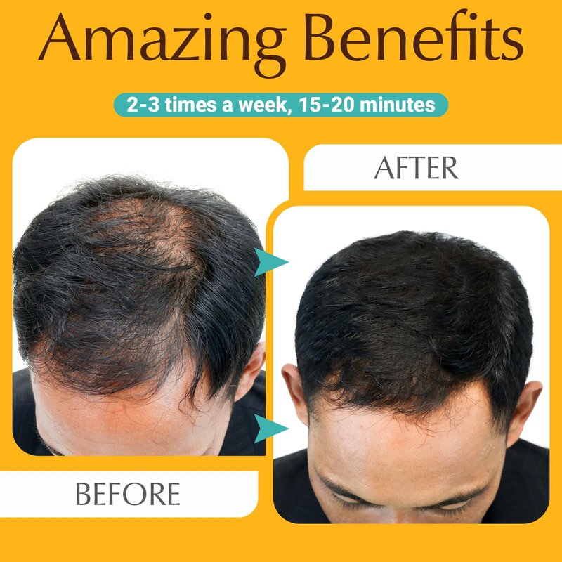 Hair Growth Comb