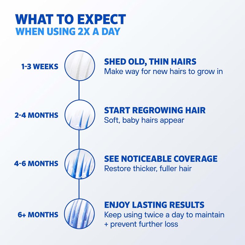 Men's Rogaine Extra Strength 5% Minoxidil | Hair Loss Treatment & Regrowth Solution, Unscented, 2 fl. oz