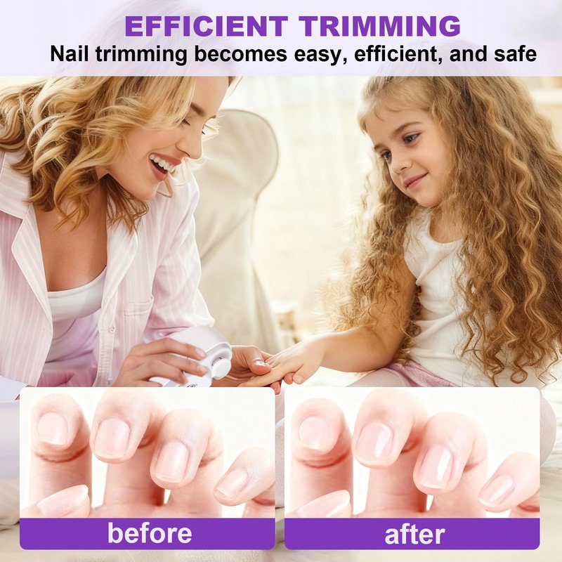Electric Nail Clipper, 2 in 1 Electric Nail Clippers for Seniors and Adults, Baby Automatic Nail Clipper with Polishing, Light & Storage, Smart Nail Clipper 2-Speed for Fingernail (White)