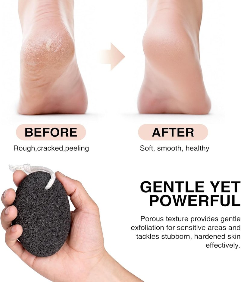 Natural Pumice Stone Set - 3 Oval Volcanic Lava Foot Scrubbers for Callus & Cracked Heel Exfoliation | 4 x 2.8 x 1.6 Inches