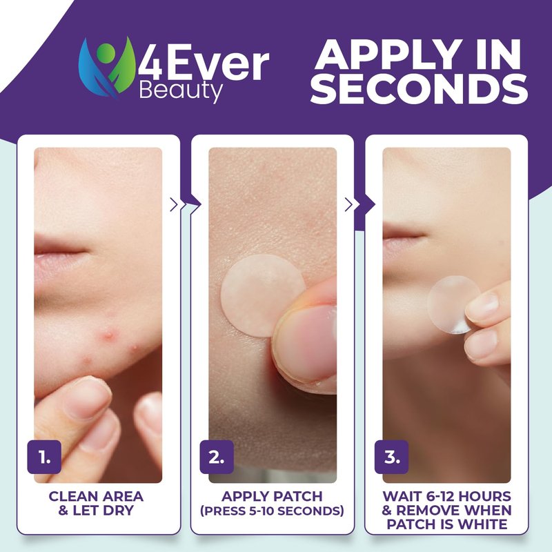 4Ever Beauty Hydrocolloid Pimple Patches for Face & Body | Ultra-Thin Invisible Acne Spot Covers | Pimple Stickers 36 Count (12mm) | Original