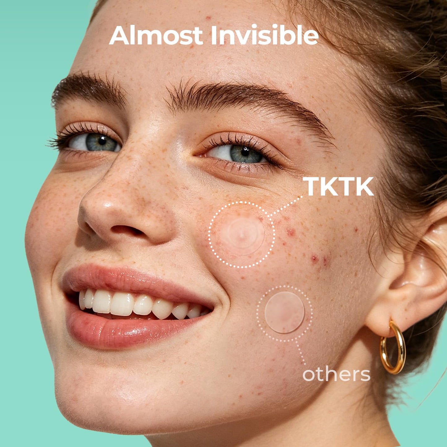 TKTK Pimple Patches for Face, 0.01cm Ultra-Thin Invisible Acne Patches, Hydrocolloid Patches for Breakouts, Absorbs Zits & Blemish, Suitable Under Makeup, 2 Sizes(10mm/12mm) 168 count