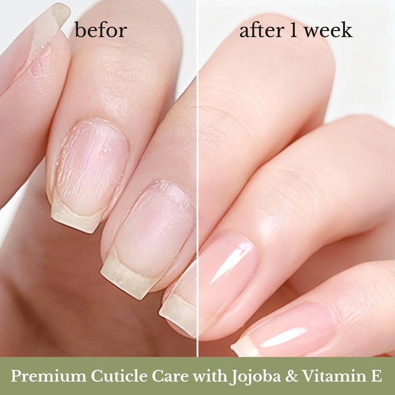 NOVAL Roll on Cuticle Oils for Men & Women, Rollerball Travel Size Bottle, Fresh Smell Cedar Scent, Male Nail Care Serum, Rich in Jojoba Oil, Natural Ingredients