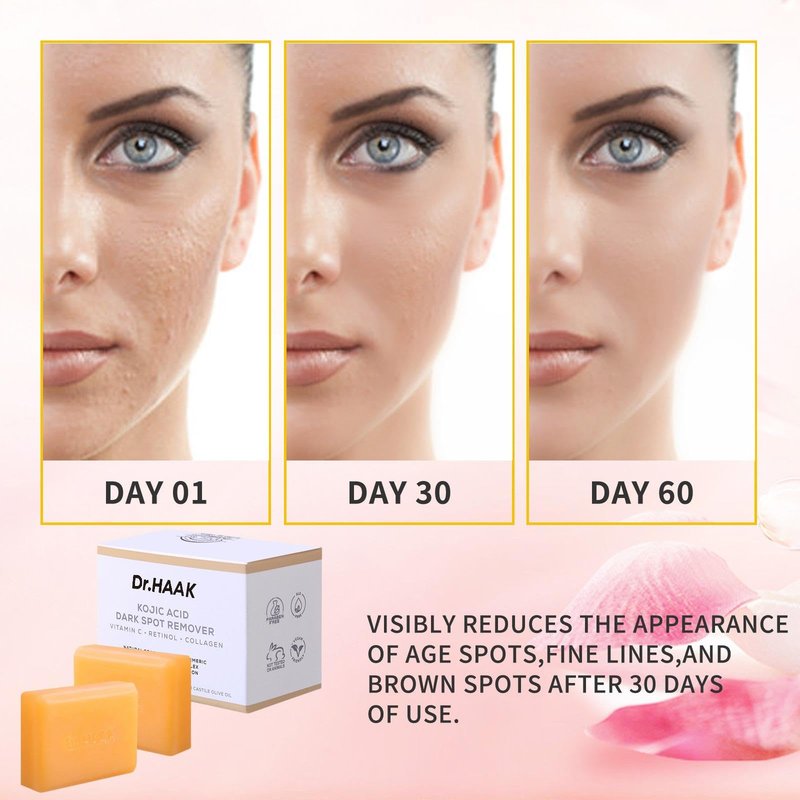 Dr. HAAK Kojic Acid Dark Spot Remover Soap –Skin Brightening Bar with Vitamin C, Retinol, Collagen & Turmeric –Formula with Hyaluronic Acid, Vitamin E, Shea Butter & Castile Olive Oil (2 Pack)