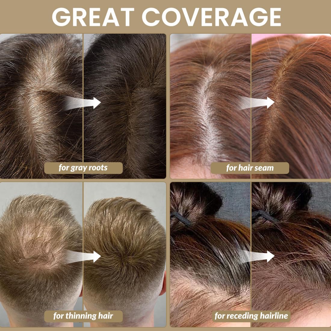 VOLLUCK Root Touch up Powder, Instant Hairline Powder for Thinning Areas and Gray Hair Coverage, Natural and Non-greasy Root Cover up for Women and Men (Black, 0.14 Ounce)