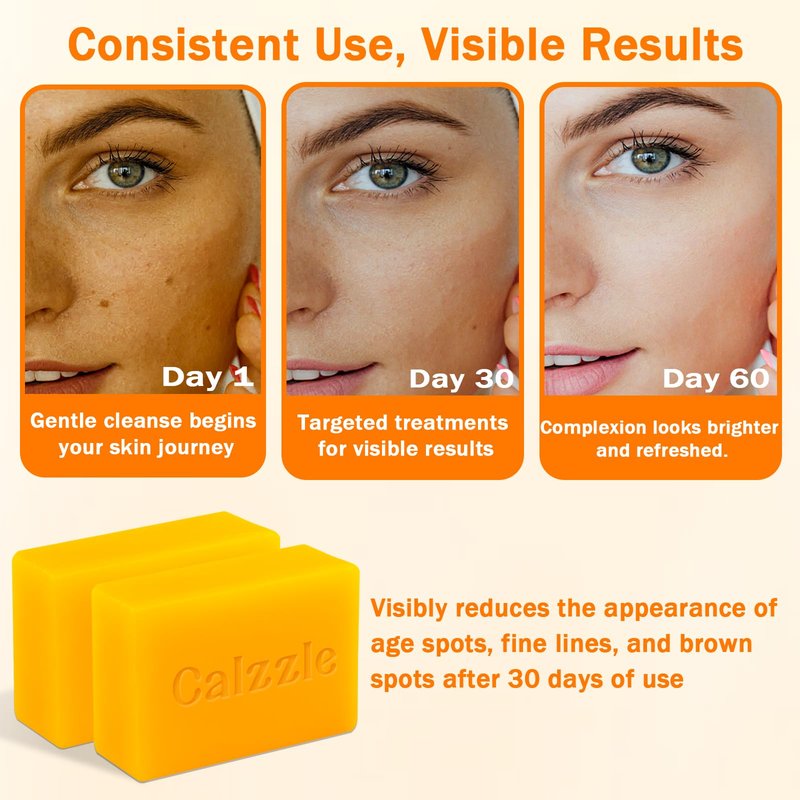 Calzzle Kojic Acid Soap 4PCS, Dark Spot Remover & Brightening with Turmeric, Vitamin C & Retinol, Moisturizing with Collagen & Shea Butter, Gentle for Face and Body, With Soap Holder & Net, 110g Each