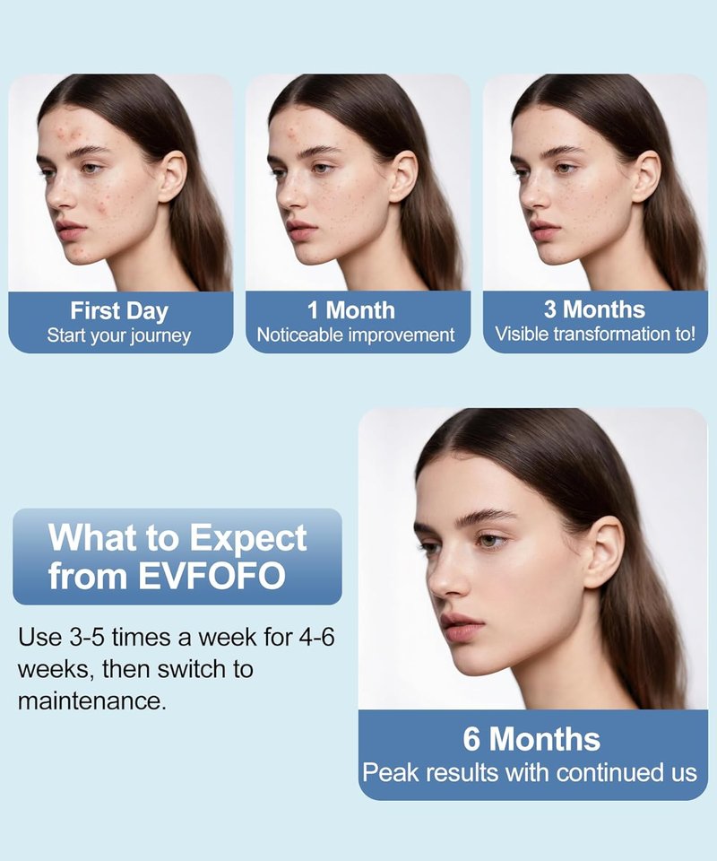 EVFOFO Red Light Therapy Mask - Cordless LED Face Treatment for Skin Rejuvenation & Anti-Aging | USB Rechargeable