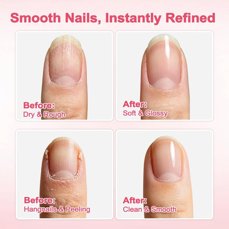 Ceramic Cuticle Pen- Polishes and Moisturizes Dry Cuticles, Instantly Removing Dead Skin and Leaving Nails Cleaner and Shinier