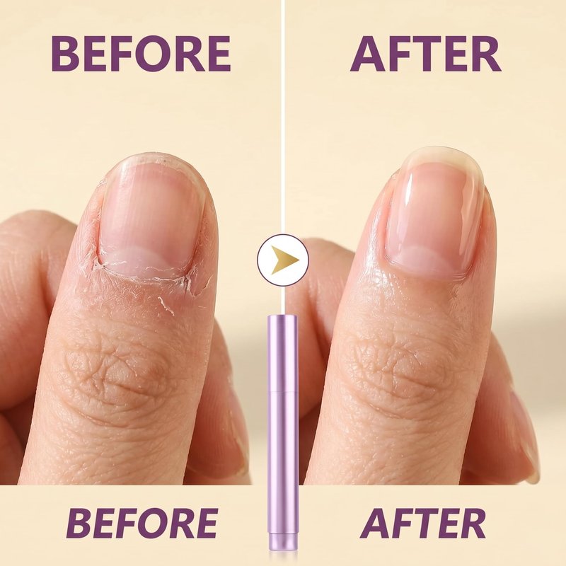 5 Pack Cuticle Oil Pusher Pen, 2-in-1 Ceramic Cuticle Pusher & Nail Oil Pen, Nail Care Tool for Manicure Pedicure, Repairs Dry Cuticles Hangnails & Damaged Nails