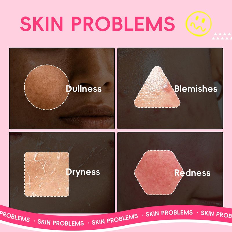 QUIYUM 14 Pack Watermelon Niacinamide Sheet Mask - Hydrating Facial Masks for All Skin Types, Skincare Set, Spa Gift for Women & Teens