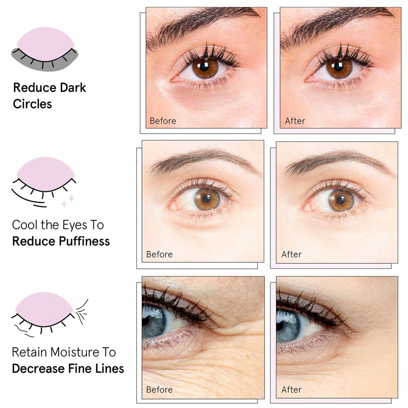 grace & stella Caffeine Under Eye Patches - Awakening Eye Patches for Puffy Eyes and Dark Circles, Under Eye Mask Patches with Niacinamide & Hyaluronic Acid - Teen Girl Gifts, Vegan (Bronze, 24 Pairs)