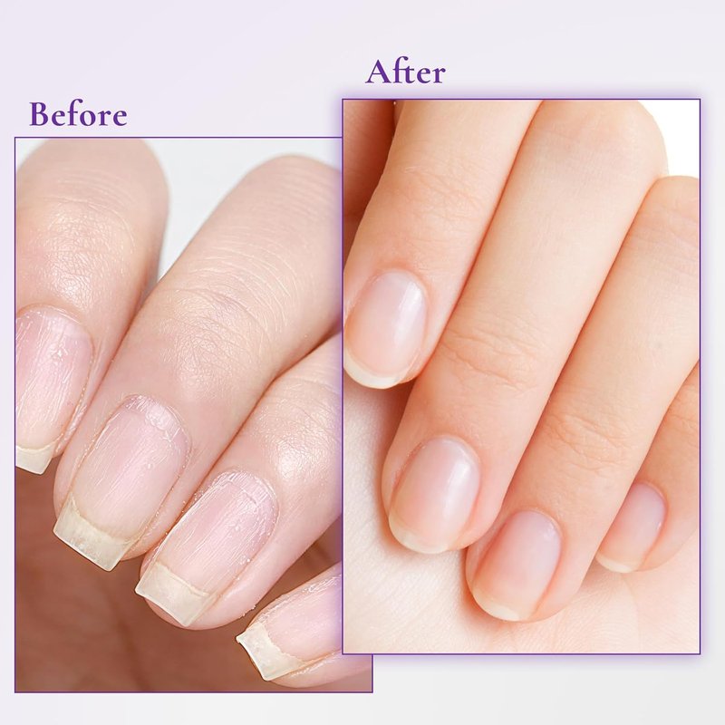 Nail & Cuticle Cream with Keratin, Biotin & Ceramides – Non-Greasy Deep Hydration, Strengthens Nails & Softens Cuticles, 15ml(Pack of 1)