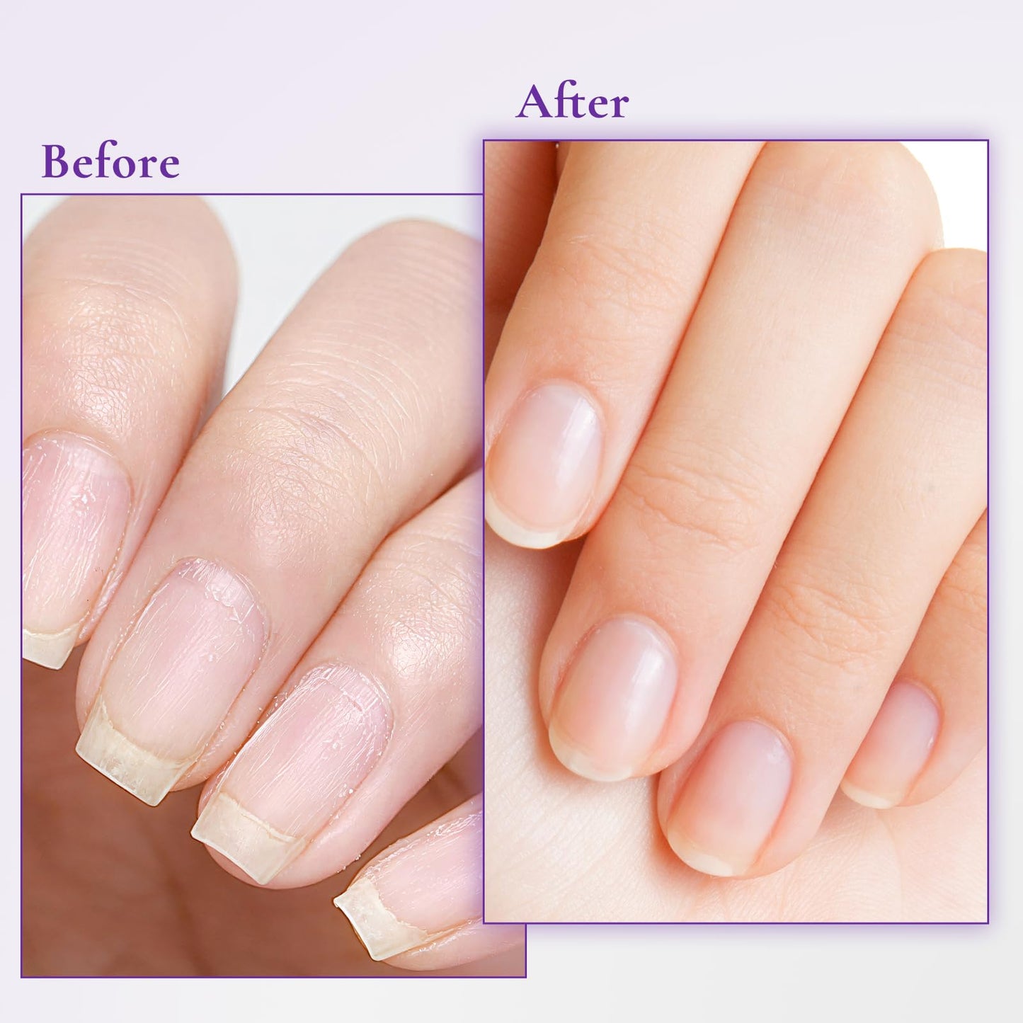 WM WONDER MOJO Nail & Cuticle Cream with Keratin, Biotin & Ceramides – Non-Greasy Deep Hydration, Strengthens Nails & Softens Cuticles, 15ml(Pack of 1)