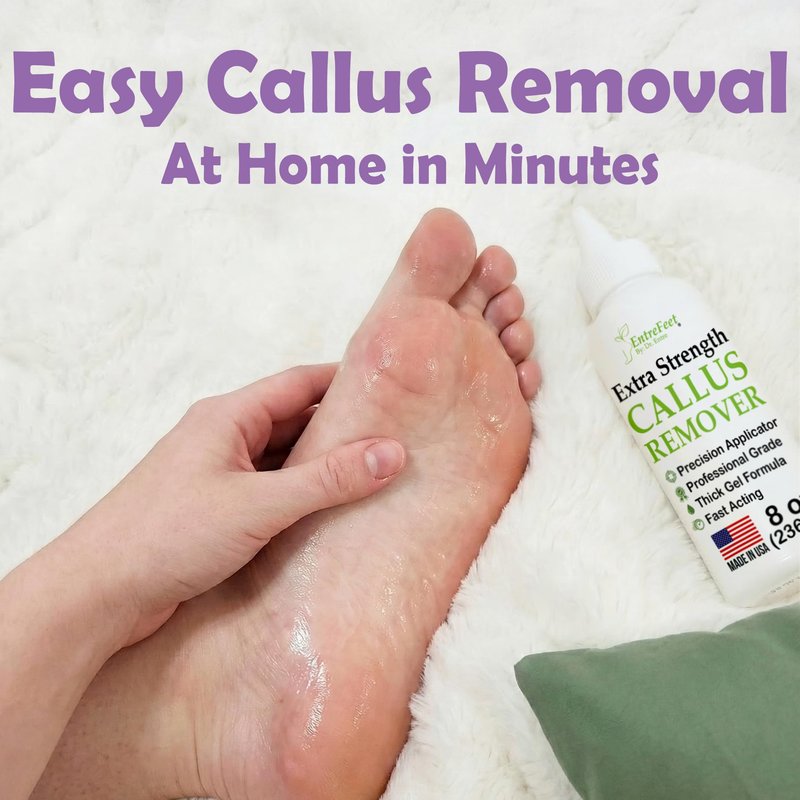 Callus Remover for Feet (Extra Strength 8 oz) Foot Callus Remover Gel, Spa Foot Care, Pedicure Tools for Feet Scrubber