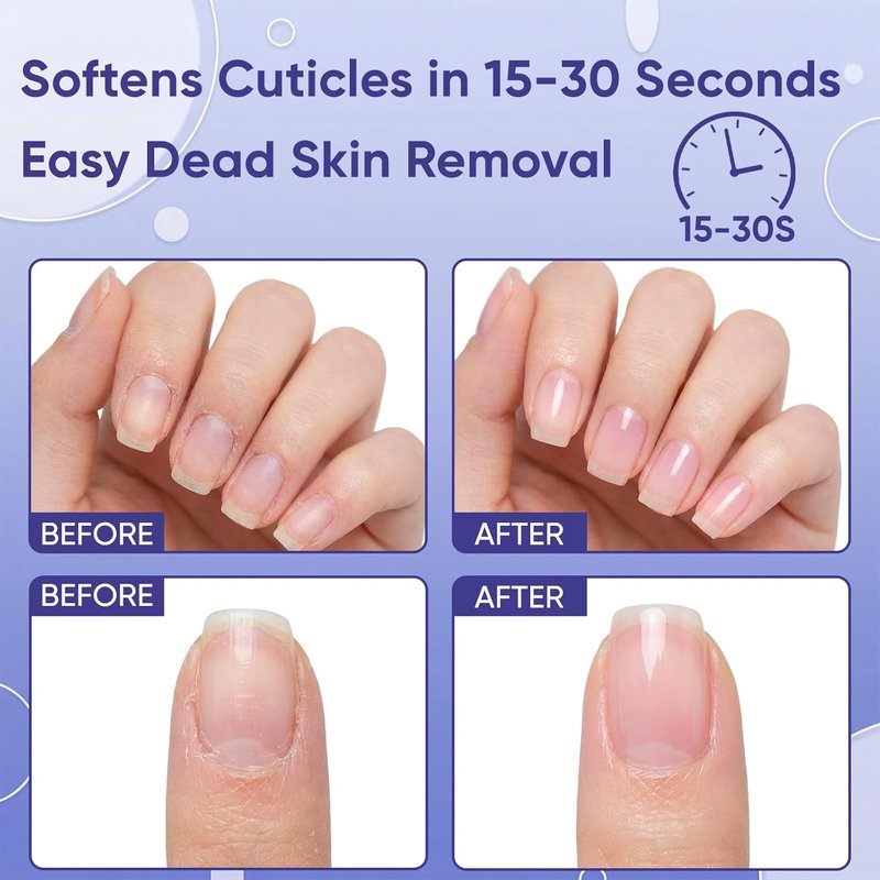 Cuticle Remover Gel, Instant 15-Second Cuticle Softener & Remover Liquid, Gentle No-Scratch Formula for Soft Nails, at-Home Manicure & Pedicure for Nail Techs & Beauty Lovers, 1 fl. oz. (Clear)