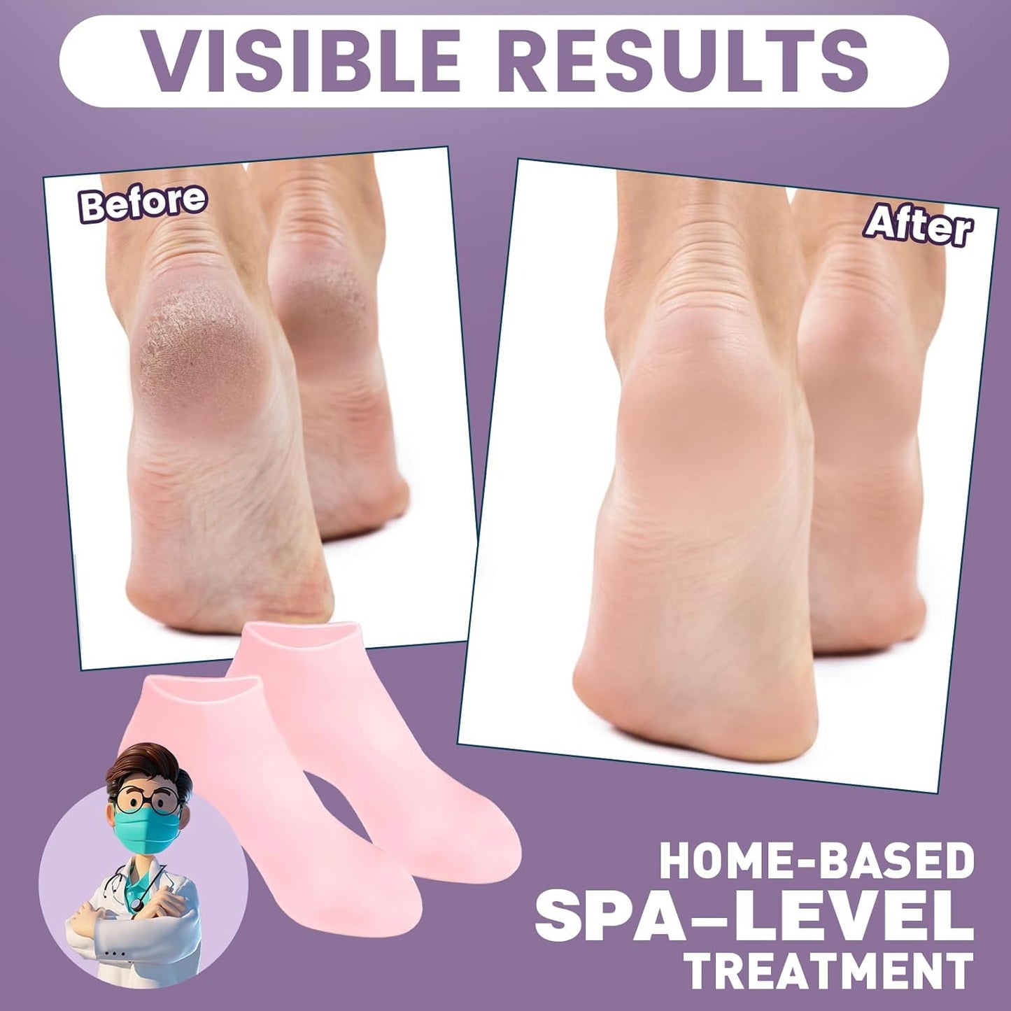 TEAWOO Silicone Moisturizing Socks - 2 Pairs for Dry, Cracked Feet | Women's Foot Care (Pink & Beige, Size 9)