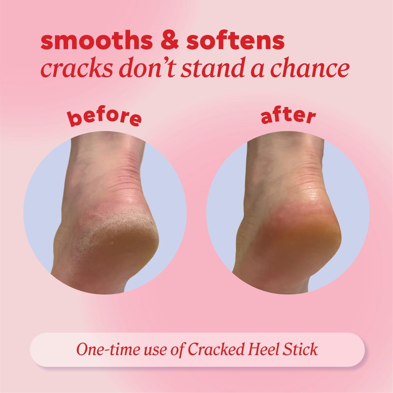 Onyx Professional Cracked Heel Repair Balm Stick for Dry Cracked Feet Treatment, Coconut Scent, 1 pack - Moisturizing Foot Balm, Rolls On, Cracked Heel Treatment