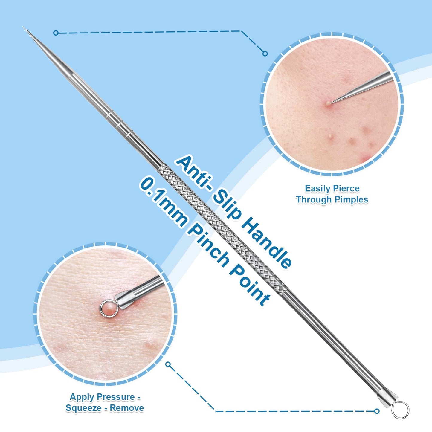 Vybiekr Stainless Steel Blackhead Remover, Pimple Extractor, Pimple Popper, Comedone Extractor, Surgical Grade Acne Treatment Tool, 3rd Generation Blemish Removal Kit for Face, Nose, T-Zone, 2Pcs