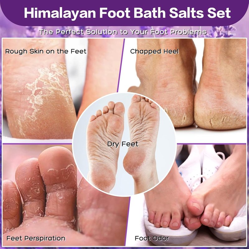 Epsom Salt Foot Soak Kit - 46 oz | Natural Rose & Lavender Essential Oils for Athletes' Foot Relief