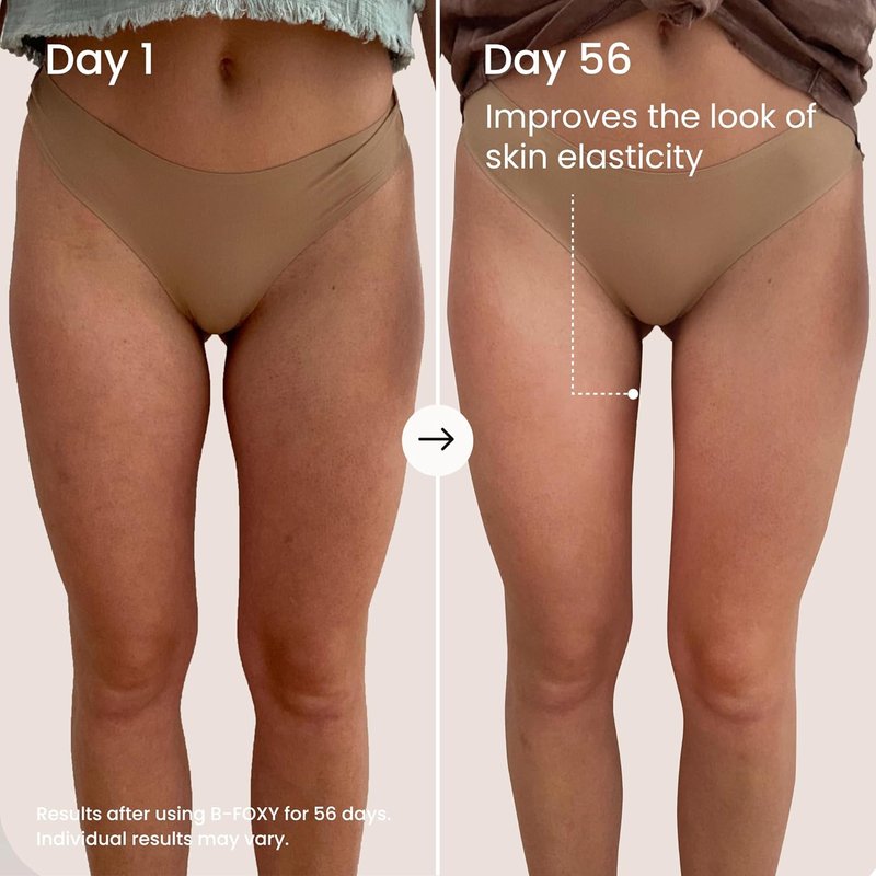 MAËLYS B-FOXY Inner Thigh Firming Cream - Skin Tightening & Nourishing Coconut Oil - 3.38 Fl Oz for Smooth, Toned Legs
