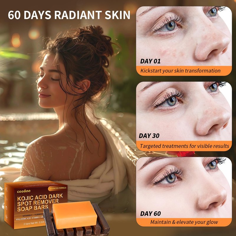 ceedoo Kojic Acid Soap for Dark Spot Remover Bars with Turmeric, Vitamin C, Retinol, Collagen with Hyaluronic Acid, Vitamin E, Shea Butter, Castile Olive Oil - 3.52 OZ x 2 Bars with Soap Holder & Bag