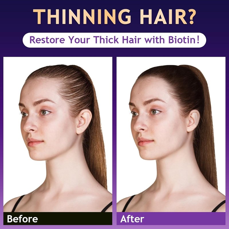 Biotin Hair Growth Shampoo - Sulfate-Free Thickening Formula for All Hair Types | 10.1 Fl Oz