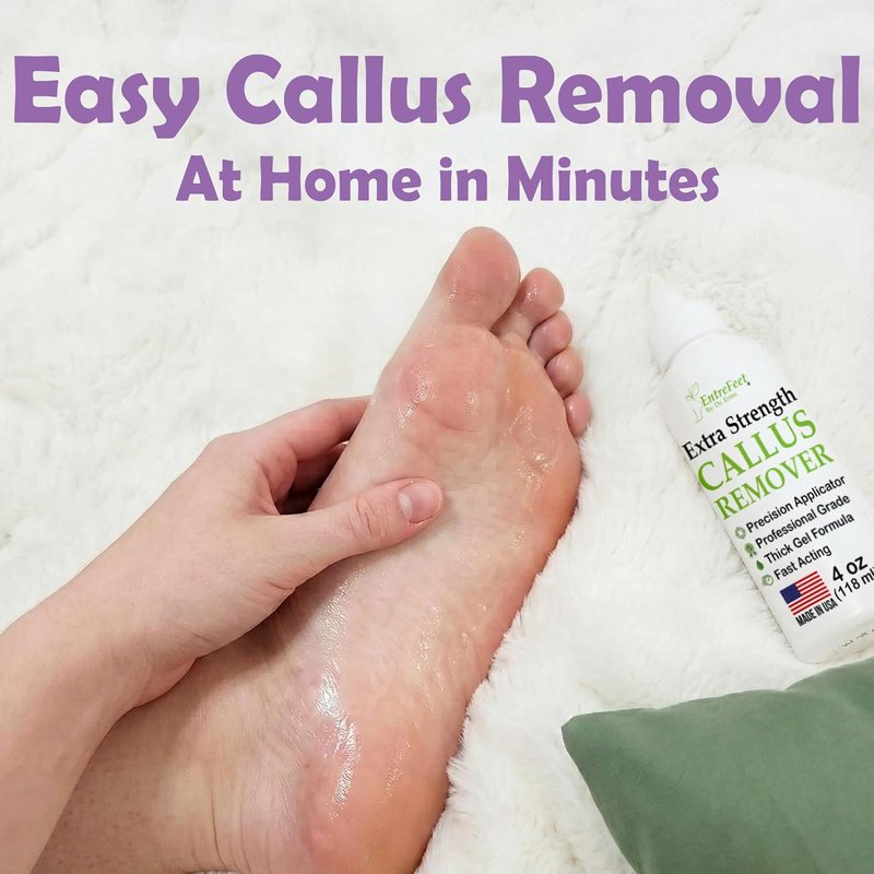 Dr. Entre's Callus Remover Gel - Extra Strength Foot Care Solution for Smooth Feet | 4 oz