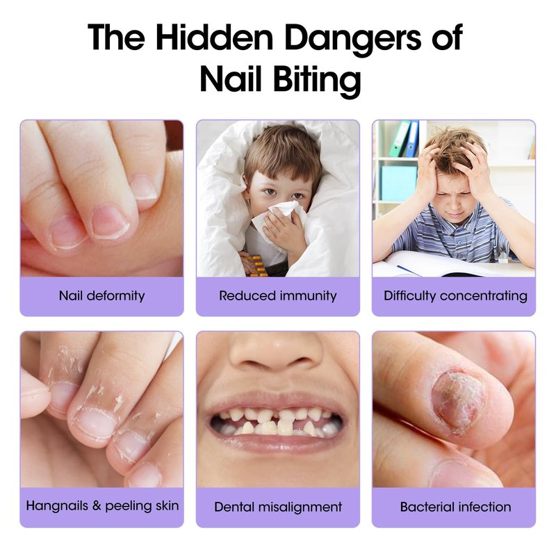 Gellen Nail Biting Treatment for Kids & Adults - 15ml Safe Nail Biting Prevention Thumb Sucking Deterrent Bitter Taste No Biting Nail Polish Nail Care Solution to Help Stop Finger Biting & Nail Repair