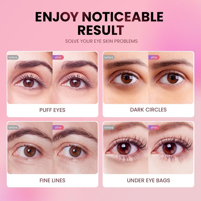 AILEORY Under Eye Patches (24 Pairs) - Tri-color Glitter Eye Gel Pads for Dark Circles, Puffy Eyes, Under eye Bags, Wrinkles | Natural Collagen Under Eye Mask Patches, Gel Under Eye Patches