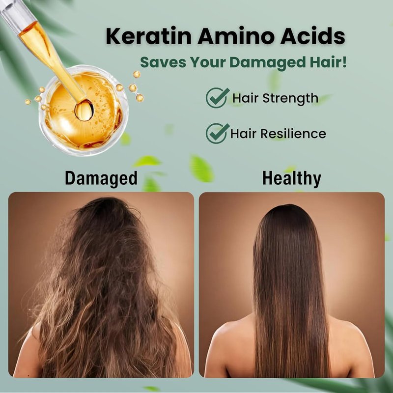Moist Diane Anti-Dandruff Shampoo & Conditioner Set - Hydrating Formula with Keratin & Argan Oil | 30.4 Fl Oz