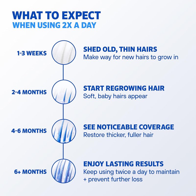 Men’s Rogaine 5% Minoxidil Foam - Clinically Proven Hair Regrowth Treatment | Unscented, 3-Month Supply, 3 x 2.11 oz