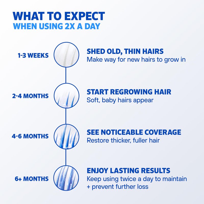 Men’s Rogaine 5% Minoxidil for Men Foam, Clinically Proven Regrowth for Thinning Hair, Topical Hair Loss Treatment, Unscented Topical Aerosol, Results in 8–16 Weeks, 3-Month Supply, 3 x 2.11 oz