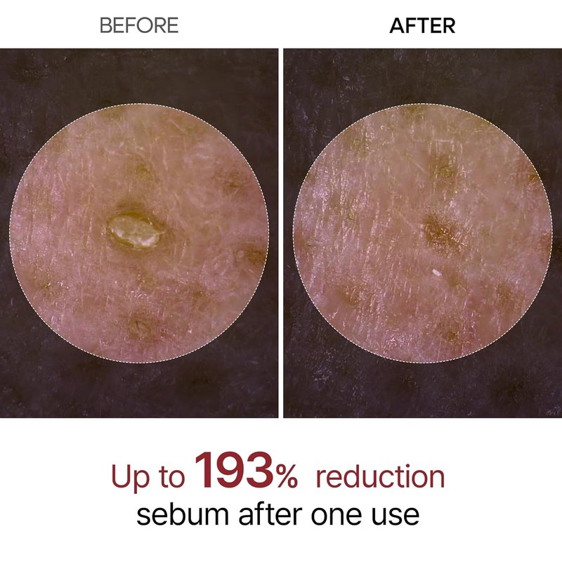 Dr. Melaxin Glow White Rice Peeling Ampoule - Brightening Exfoliating Serum with AHA/BHA, Niacinamide & Hyaluronic Acid | 2.71 fl. oz
