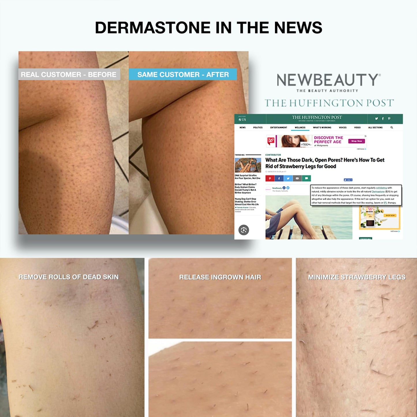 DERMASTONE LEG & BODY SCRUB - Deep Exfoliating Stone Body Scrubber for Strawberry Legs Treatment, Leg Exfoliator Ingrown Hair, Dead Skin Remover, Foot Scrub & Natural Body Exfoliator for Women Men