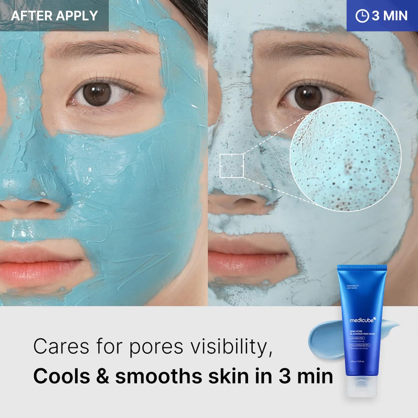 medicube Zero Pore Blackhead Mud Facial Mask - Skin Cooling & Pore Tightening - 3 Minute Quick Dry Formula with AHA, BHA, PHA, and Pore-Purifying Clay - Korean Mud Mask 3.52 oz