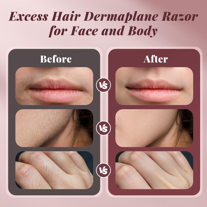 Dermaplane Razor for Women Face, BNU Facial Hair Remover for Anti-Aging, Rechargeable, LED Light, Sonic Edges, 3 Speeds, Ergonomic Handle Face Dermaplaning Tool 10 Blades Pink