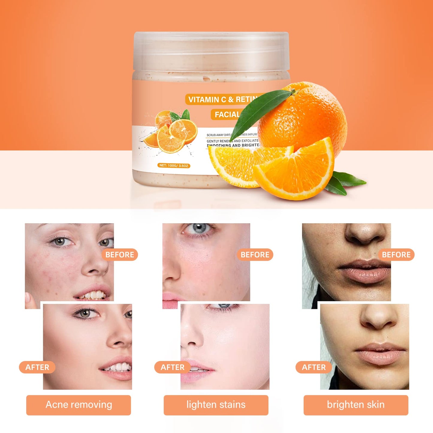 YAFUSIPE Vitamin C and Retinol Facial Scrub Face Scrubs Exfoliating Face Wash Vitamin C Facial Body Scrub Microdermabrasion Exfoliator for Blackhead Ingrown Hair KP Bump Eraser Exfoliant 3.5OZ