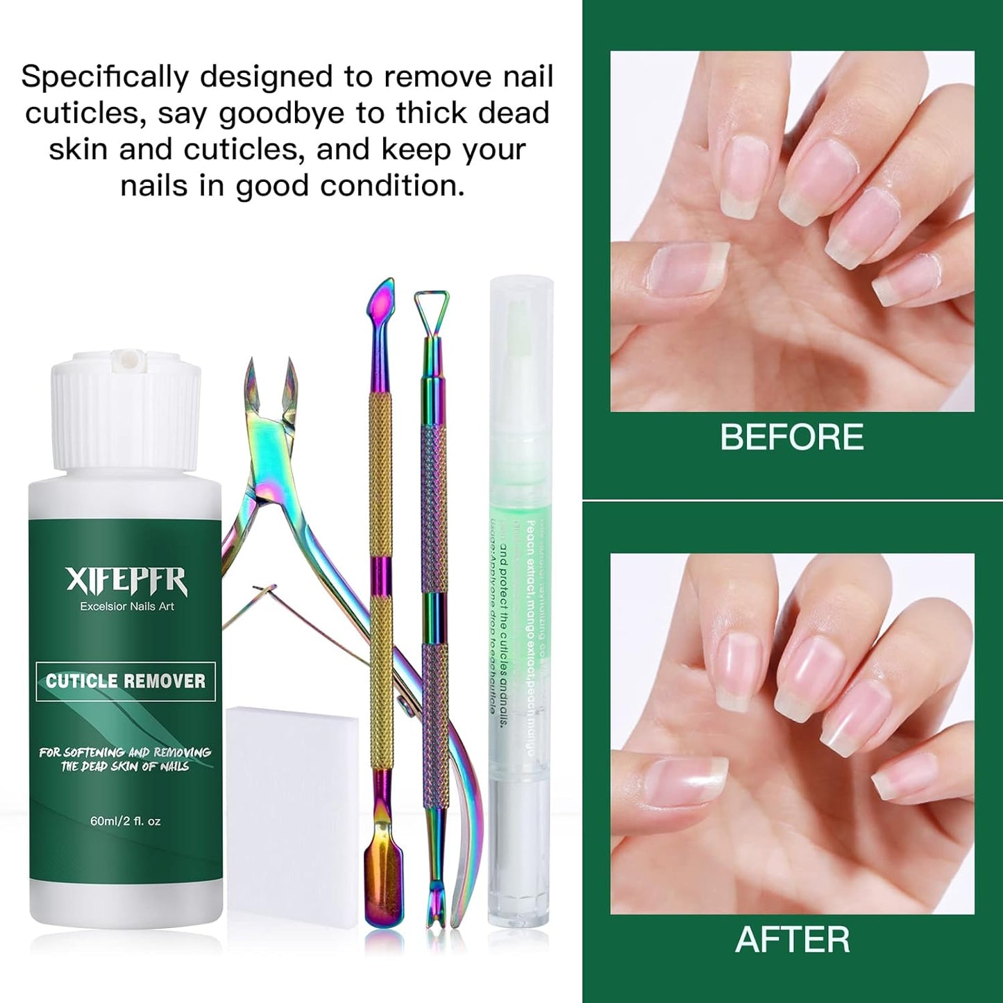 XIFEPFR Cuticle Remover Kit - Moisturizing Cream & Oil Pen with Trimmer, Pusher & Cotton Pads | Perfect Gift for Women