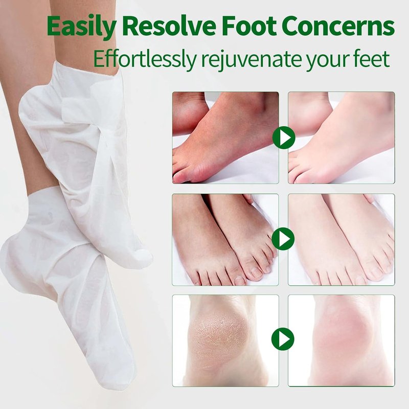 Skiennix 5-Pack Moisturizing Foot Masks - Hydrating Treatment for Dry, Cracked Feet | Spa Gift Set