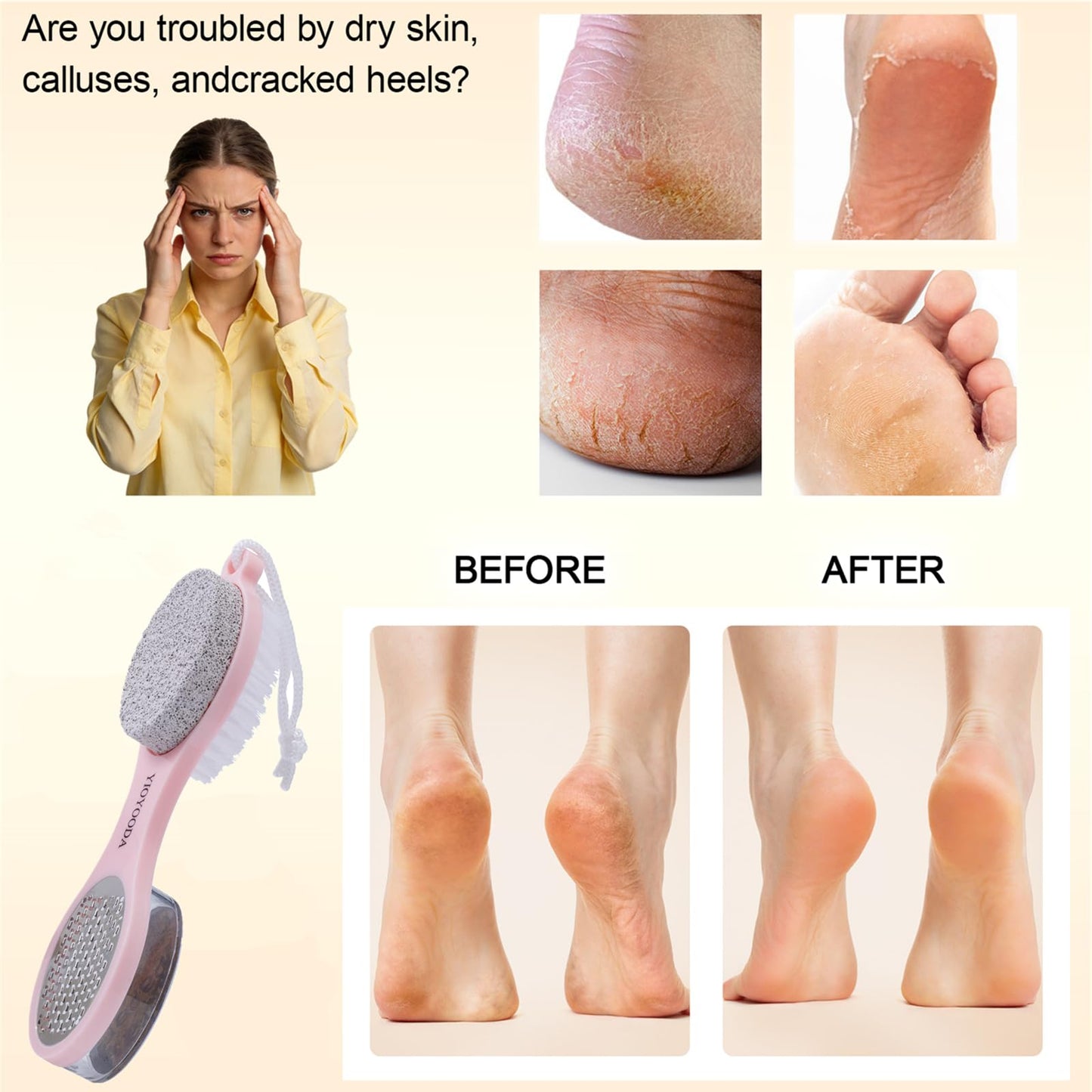 YIOYOODA Foot Scrubber Brush with Pumice Stone for Feet, 5-in-1 Foot File Callus Remover, Stainless Steel Feet Scraper, Cleaning Brush and Sand Paper Debris Catcher, Multi Purpose for Home Foot Care