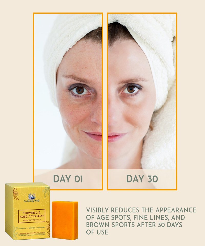 Eco Beauty Needs Original Kojic Acid Dark Spot Remover Soap Bars with Vitamin C, Retinol, Collagen, Turmeric Infused with Hyaluronic Acid, Vitamin E, Shea Butter, Olive Oil- 1 Bar