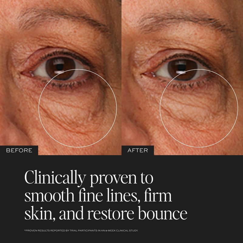 DIME Beauty TBT Eye Cream 0.5 oz (15 ml) - Smooth Fine Lines, Firm Skin, Restore Bounce, Long Lasting Hydration with Bakuchiol
