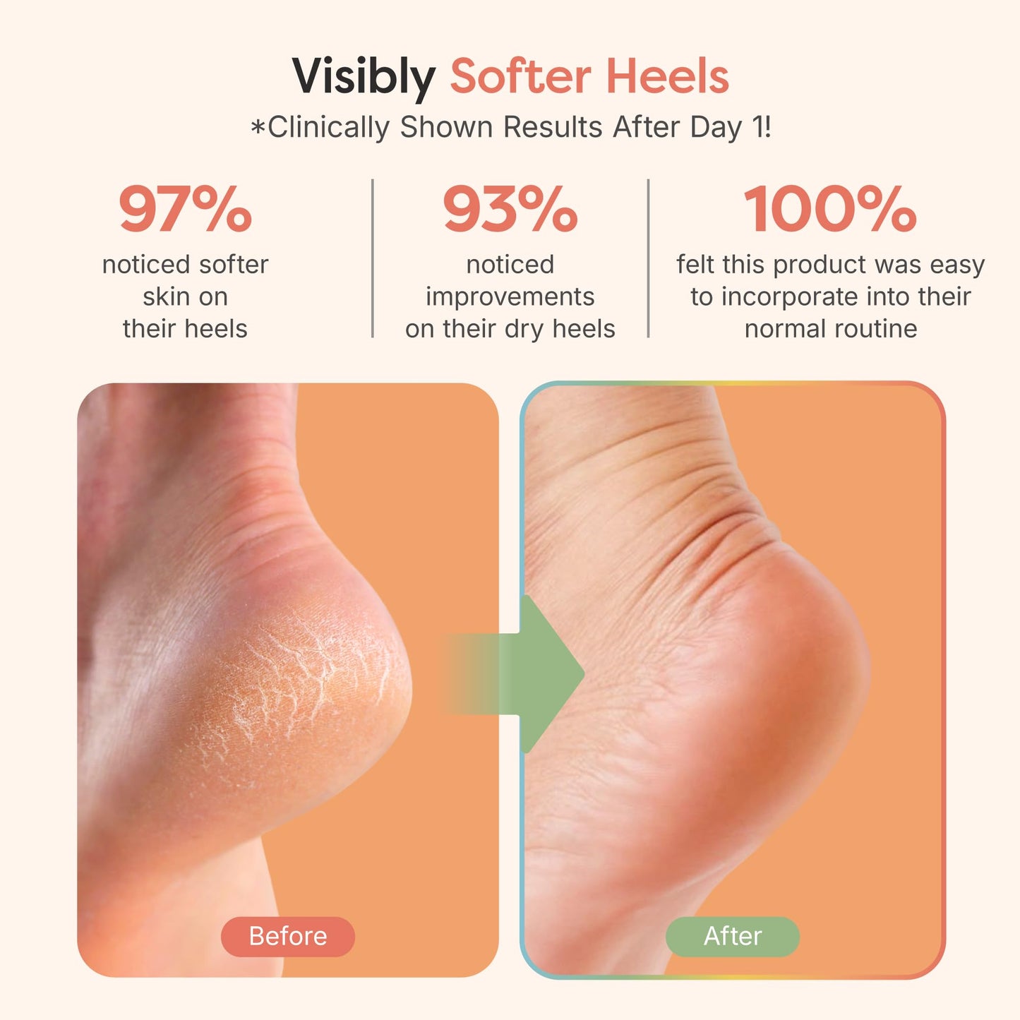 ZenToes Moisturizing Socks for Cracked Heel Treatment, Vitamin E, Olive Oil and Jojoba Oil Infused Heel Socks, Spa Gifts for Women, Mothers Day Gifts (Fuzzy Pink, Regular)
