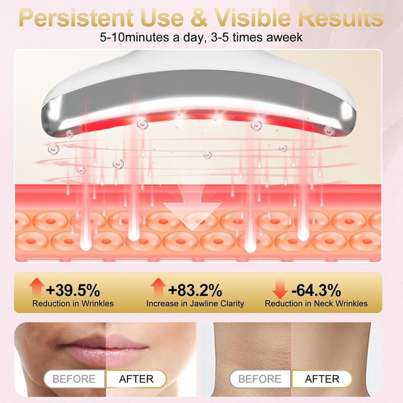 LED Facial Massager - Micro-Current Vibration & Light Therapy for Wrinkles | 4 Color Options, Cold & Hot Treatment