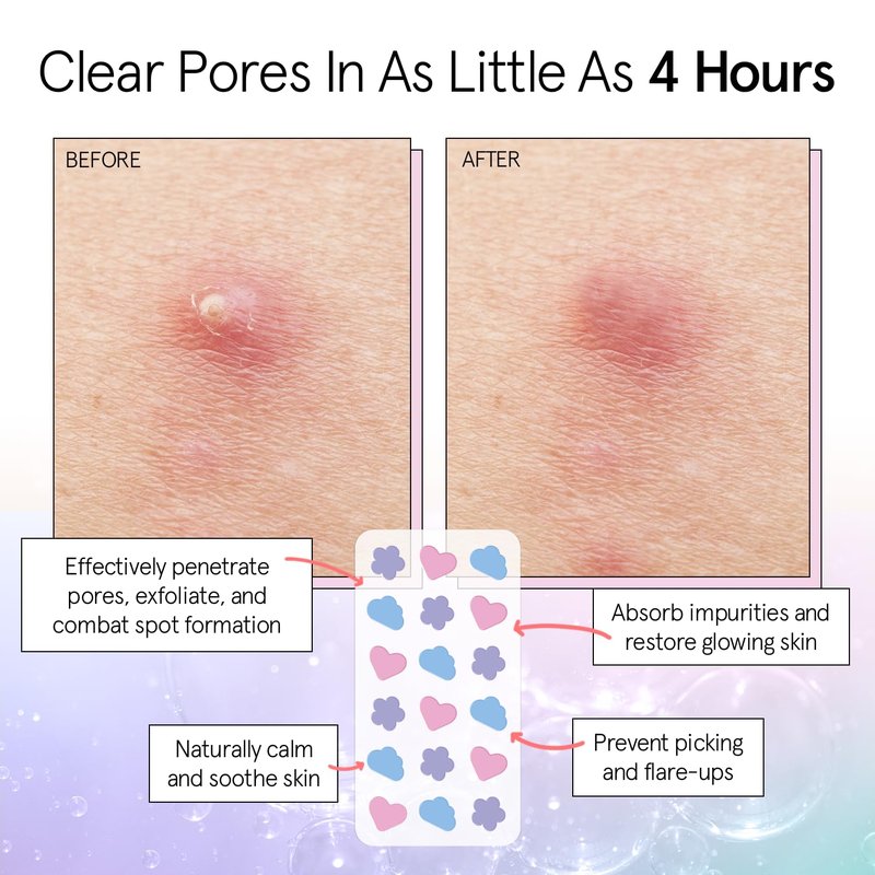 grace & stella Award Winning Pore Strip - Pimple Patches for Face - Hydrocolloid Acne Patches - Absorbs Zits, Reduces Redness - Cute Patches Dermatologist-Tested, Vegan