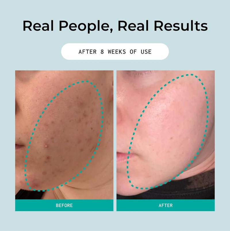 Overnight Sensation Exfoliator - Gentle Retexturizing Solution with Vitamin C & Probiotics | Vegan, All Skin Types